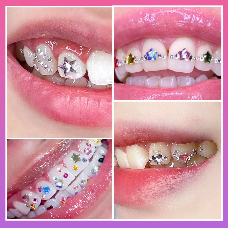 NEW Professional Tooth Gem Kit - Tooth Gem Kit ulasan dan harga
