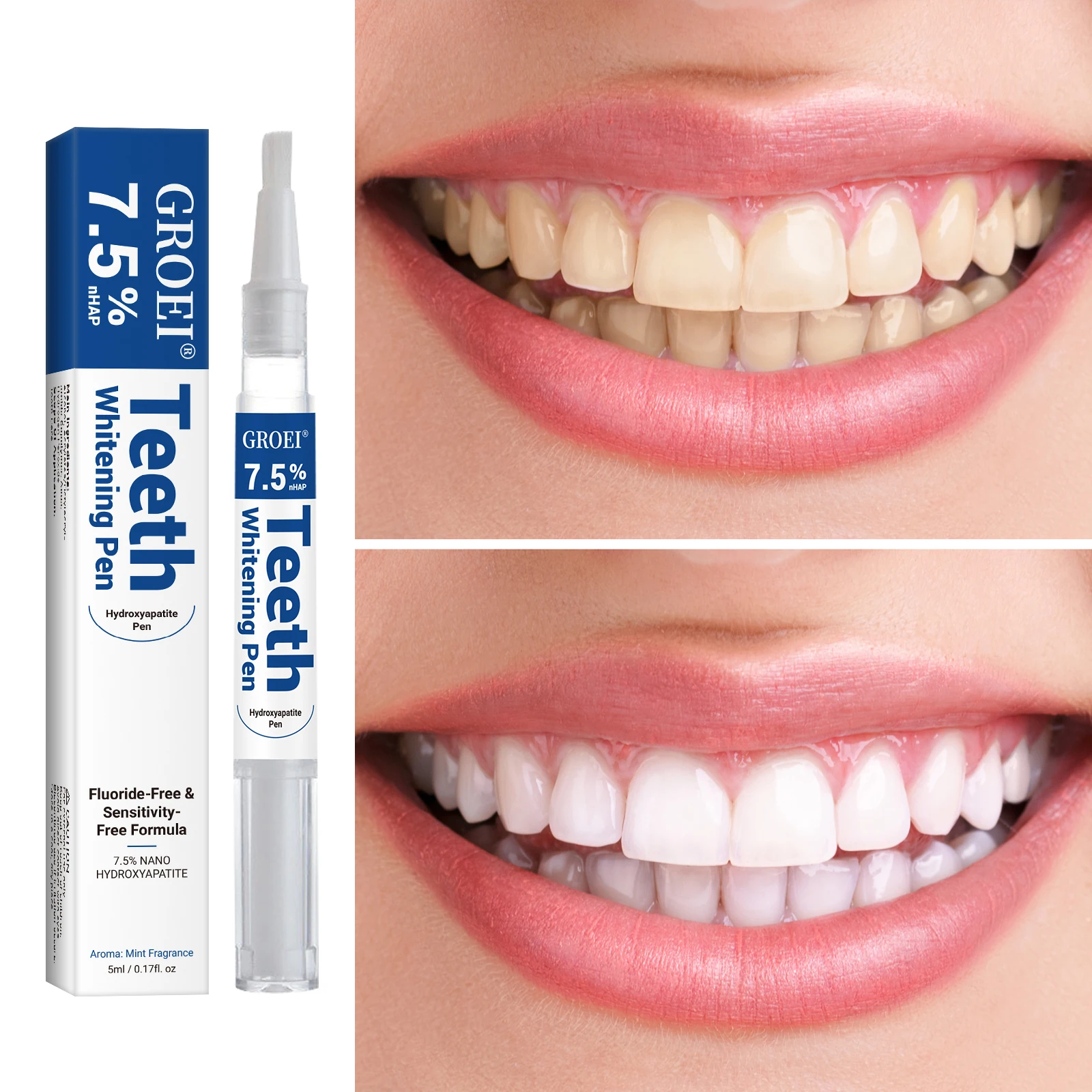 Hydroxyapatite Tooth Whitening - Teeth Whitening Gel Peroxide ulasan dan harga