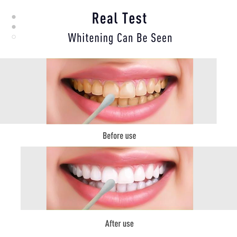 Pen Tooth Gel White  Kit Clean - Whitening Pen Bleach ulasan dan harga