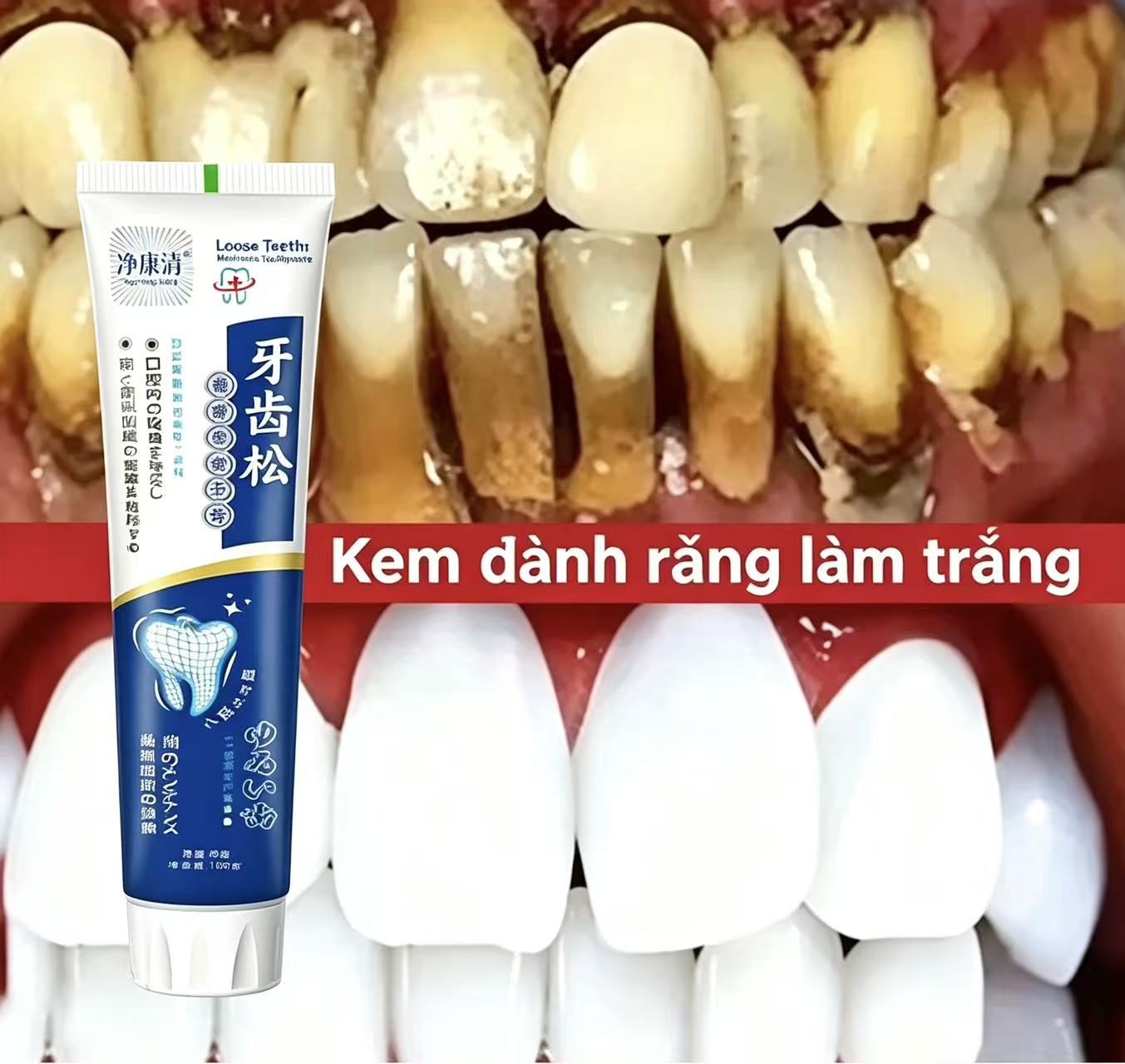 Fix Loose Teeth Japanese Impor - Teeth Whitening Japanese ulasan dan harga