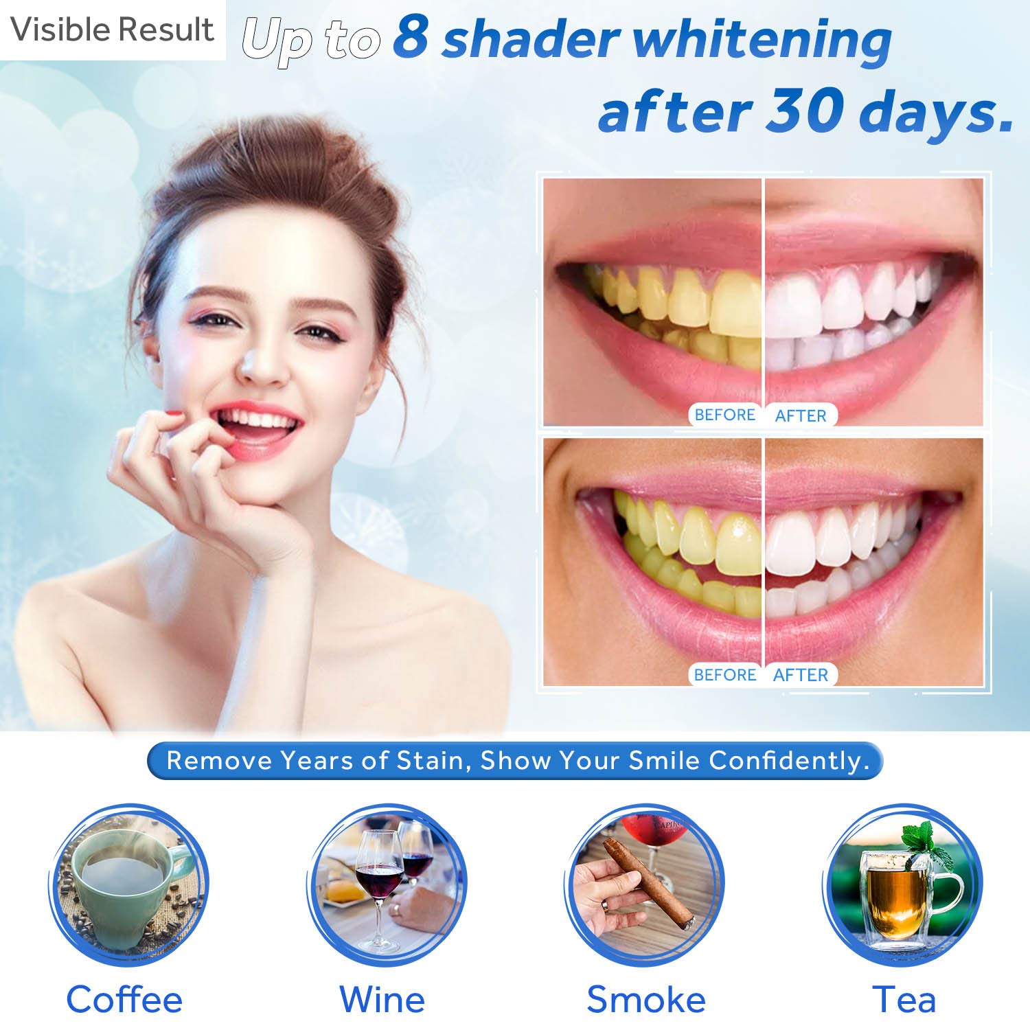 Teeth Whitening Gel Refill Syr - Teeth Whitening Gel Peroxide ulasan dan harga