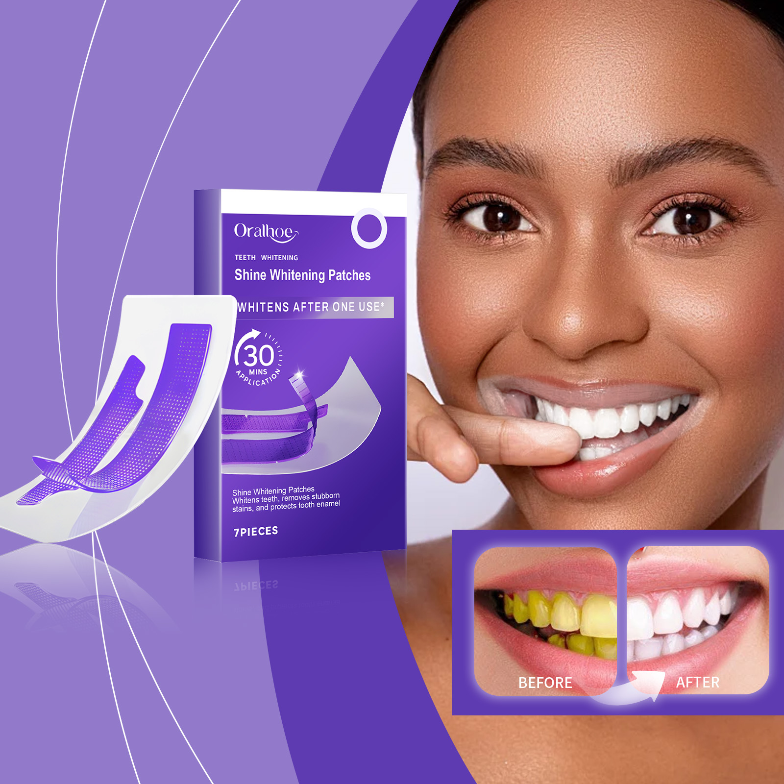Purple Teeth Whitening Strips  - Teeth Whitening At Home ulasan dan harga