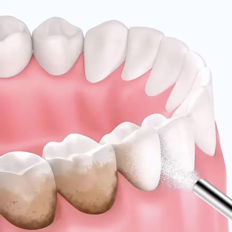 130g Dental Sandblasting Powde - Teeth Whitening Co ulasan dan harga