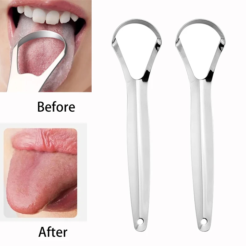 Halitosis Tongue Coating Tongu - Tongue Scraper Metal ulasan dan harga