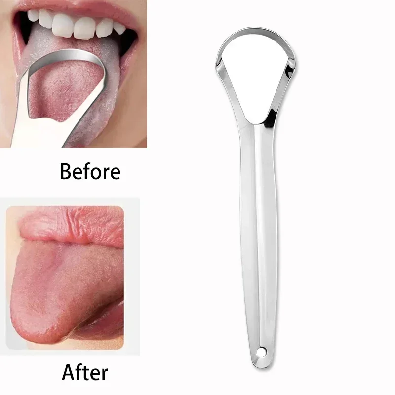 Halitosis Tongue Coating Tongu - Tongue Scraper Metal ulasan dan harga