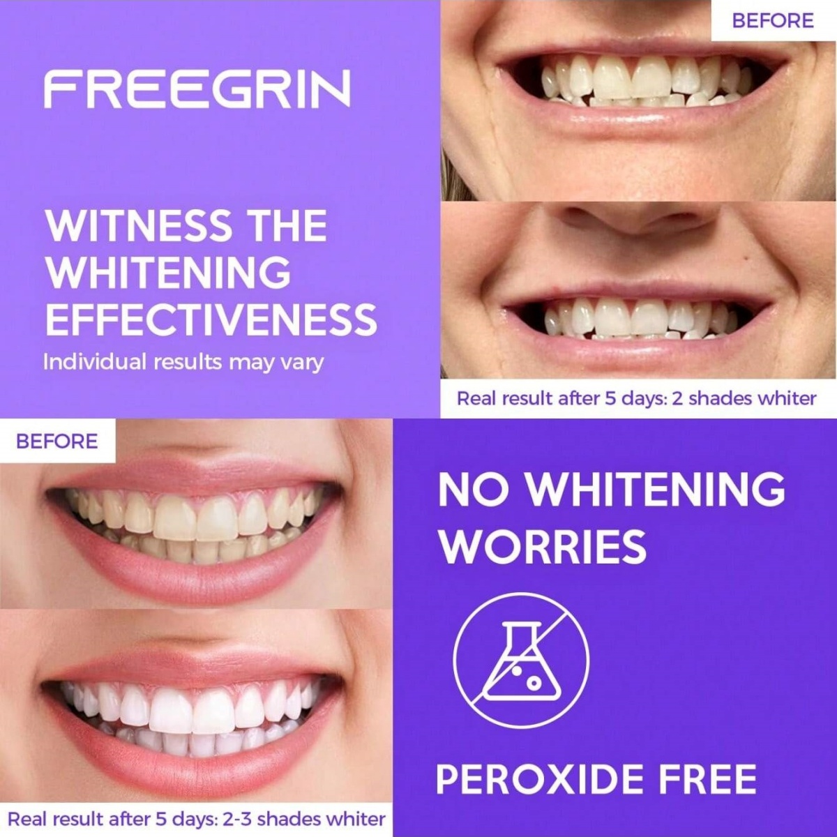 Deluxe Whitening Teeth Sticker - Teeth Whitening Gel Peroxide ulasan dan harga