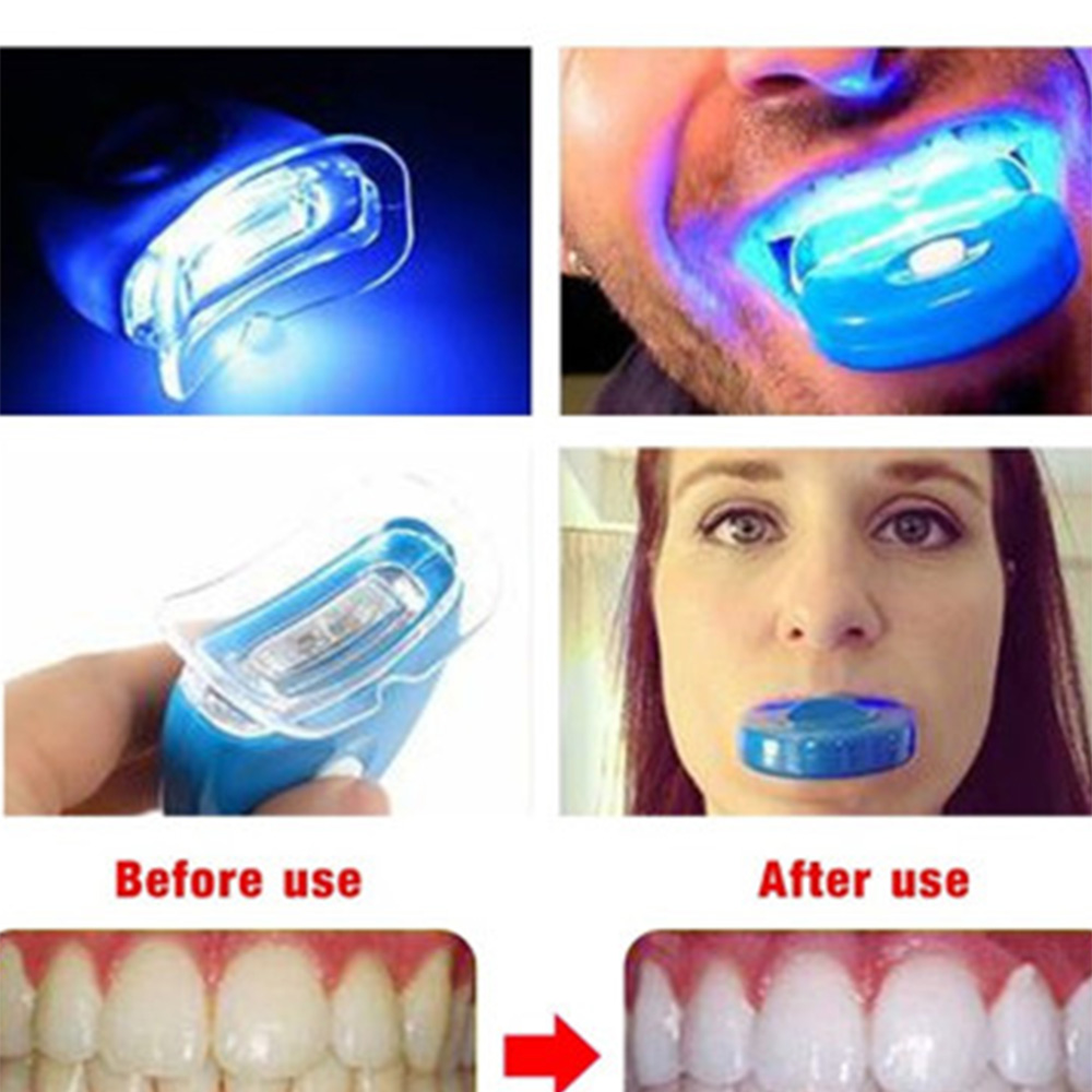 New Blue Led Teeth Whitening A - Teeth Whitening Uv Kit ulasan dan harga