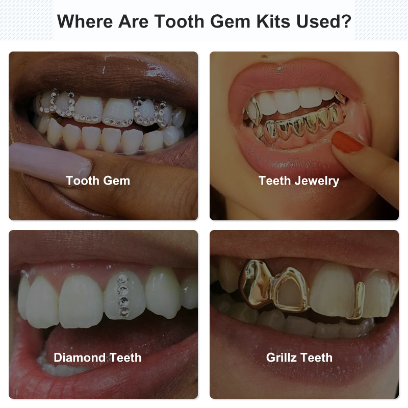 Tooth Gem Set Glue Kit with UV - Tooth Gem Kit ulasan dan harga