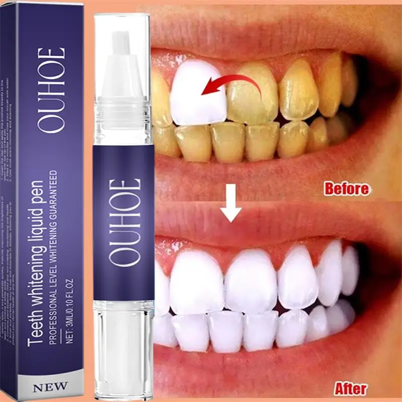 Fast Teeth Whtening Toothpaste - Whitening Pen Bleach ulasan dan harga