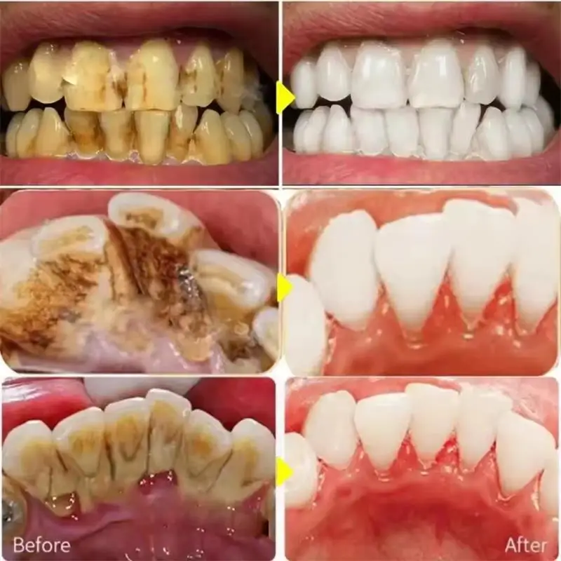 Fast Teeth Whtening Toothpaste - Whitening Pen Bleach ulasan dan harga