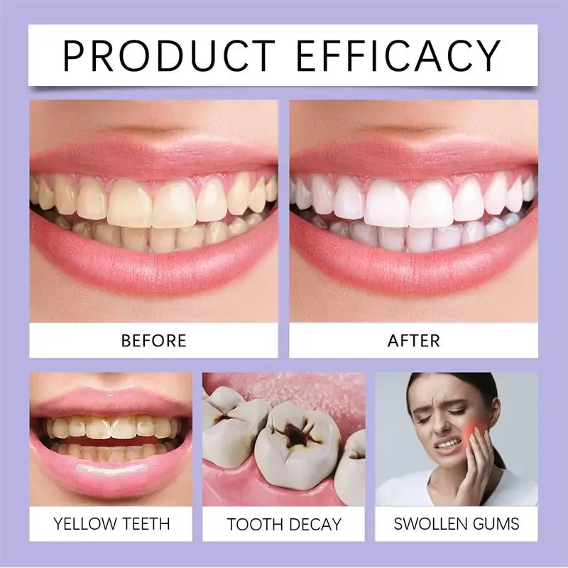 Fast Teeth Whtening Toothpaste - Whitening Pen Bleach ulasan dan harga
