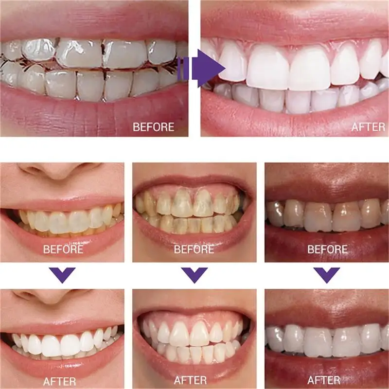 Fast Teeth Whtening Toothpaste - Whitening Pen Bleach ulasan dan harga