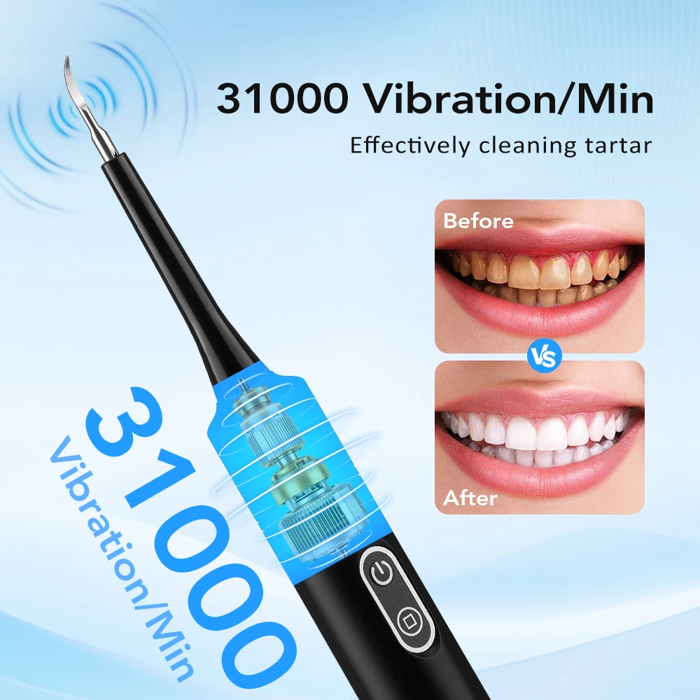 Electric Sonic Vibration Denta - Whitening Teeth Dentist ulasan dan harga
